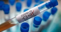 45 حالة جديدة مؤكدة لفيروس كورونا في الجزائر من بينها 3 وفيات وتعافي شخصين