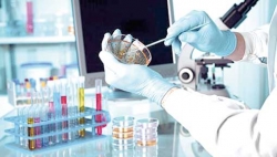 الجزائر من دول ستستفيد من تكنولوجيا تصنيع اللقاح الروسي