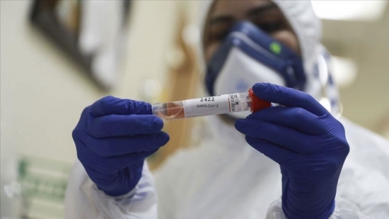 تسجيل 57 حالة جديدة مؤكدة لفيروس كورونا وحالتي وفاة جديدتين في الجزائر