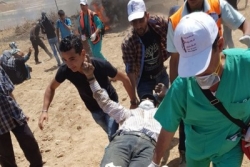 فلسطين المحتلة : ارتفاع حصيلة المواجهات على حدود القطاع إلى 8 شهداء وأكثر من 500 إصابة