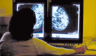 اكتشاف طريقة لمنع الإصابة بسرطان الثدي