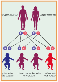 تعرّف على المرض الوراثي..