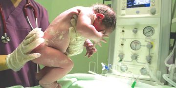 مقاربة متعدّدة التخصّصات في جراحة حديثي الولادة